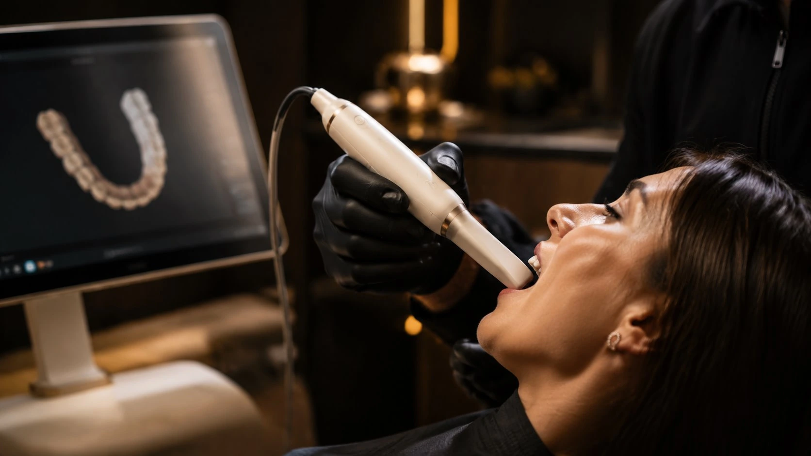 Scanner intraoral usado durante avaliaÃ§Ã£o odontolÃ³gica