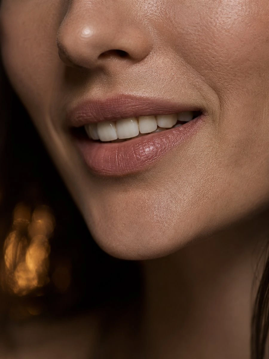 Close de sorriso usado como referÃªncia visual para estÃ©tica dental